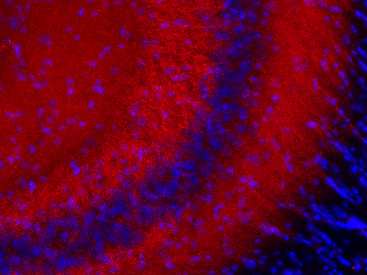 Indirect immunostaining of a PFA fixed mouse hippocampus section with mouse anti-Bassoon