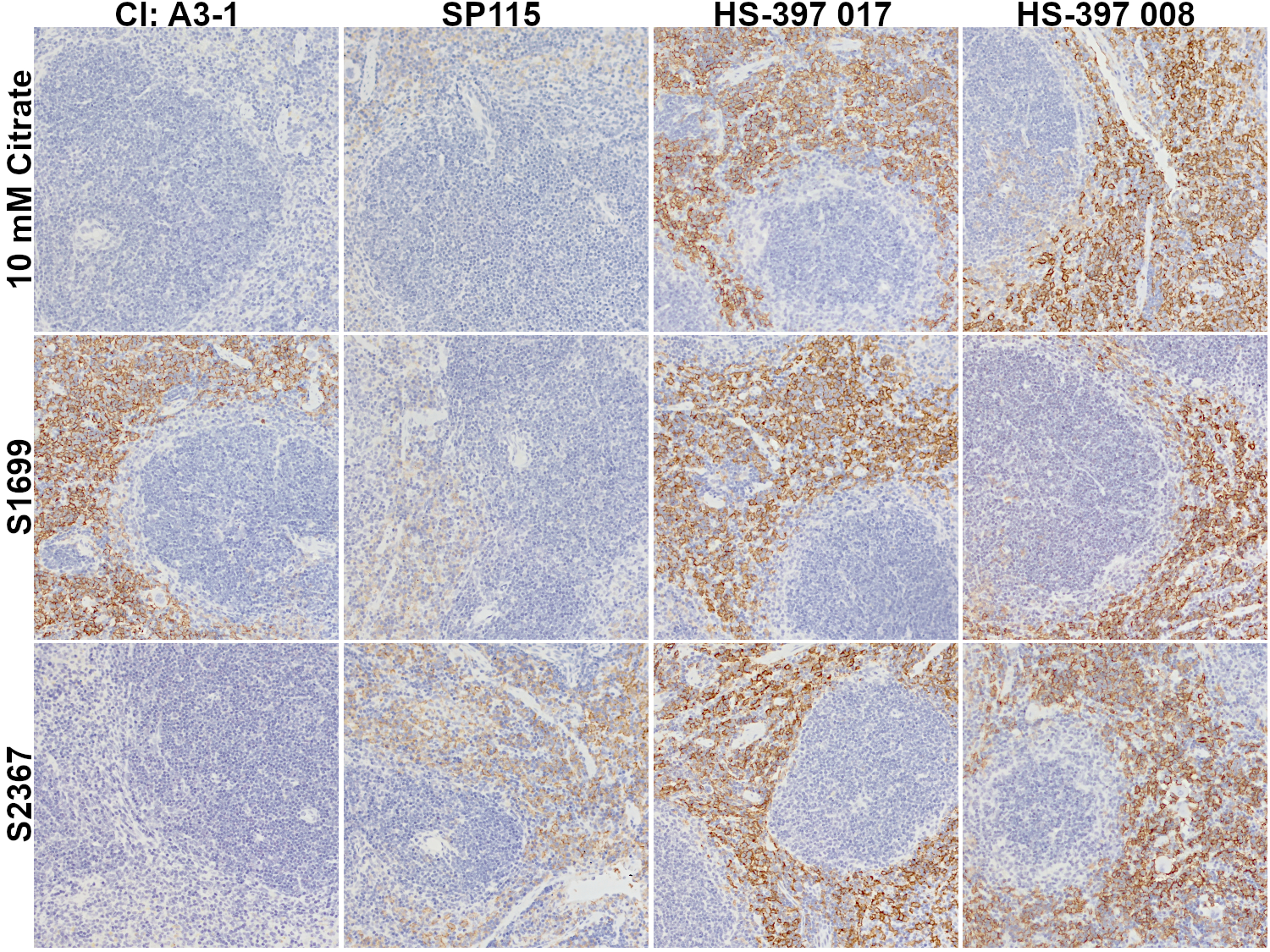 Anti-F4/80 staining in formalin fixed paraffin embedded (FFPE) mouse spleen sections using different F4/80 antibodies and AR buffers.