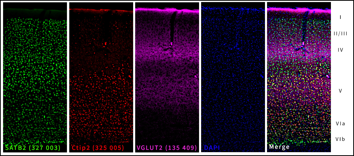 Marker of the deep layer V, Ctip2. Indirect immunostaining of a formaldehyde-fixed adult mouse cortex section with rabbit anti-SATB2 (cat. no. 327 003, dilution 1 : 1000, green), guinea pig anti-Ctip2 (cat. no. 325 005, dilution 1 : 500, red) and chicken anti-VGLUT2 (cat. no. 135 409, dilution 1 : 500, purple). Nuclei were visualized with DAPI staining (blue).