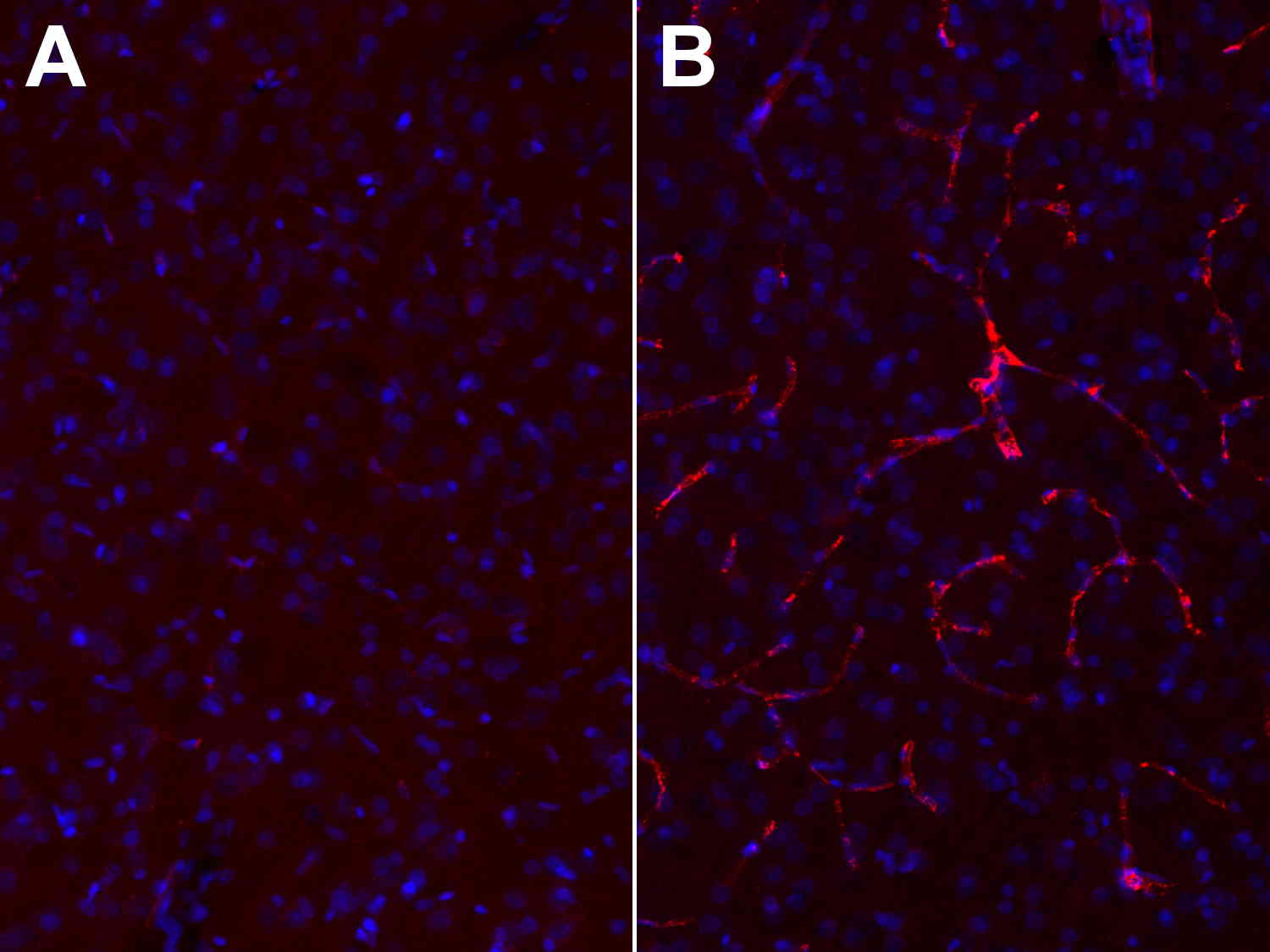 Perfusion control with a secondary anti-rat Cy3 labeled antibody in a rat brain. No blood vessels observed in the Cy3 channel in a successfully perfused brain (A) compared to a poorly perfused brain (B). Nuclei have been visualized by DAPI staining (blue).