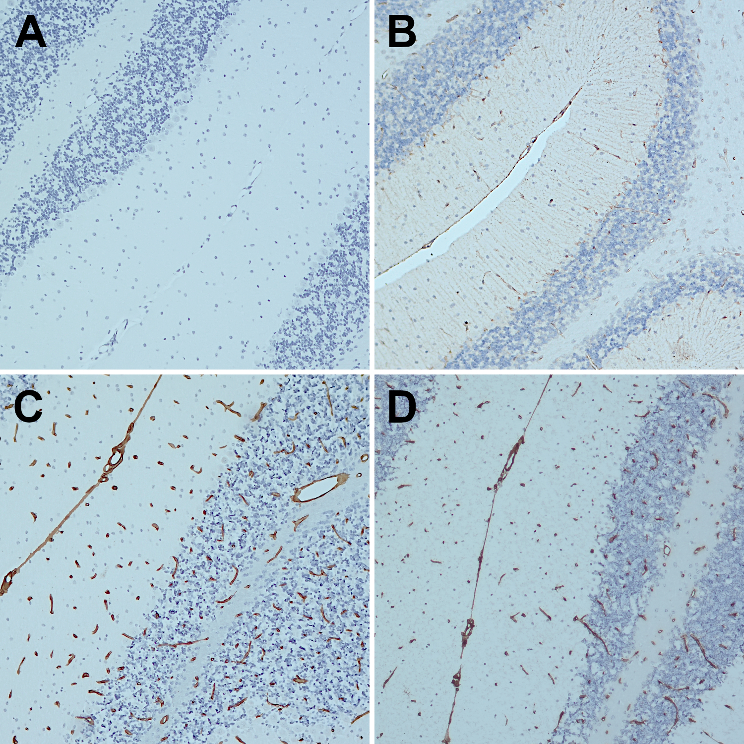 Influence of PIER and HIER methods on indirect immunostaining of formalin fixed paraffin embedded (FFPE) mouse cerebellum sections with guinea pig anti-Collagen type IV (cat. no. 462 004, dilution 1:500, DAB, brown).