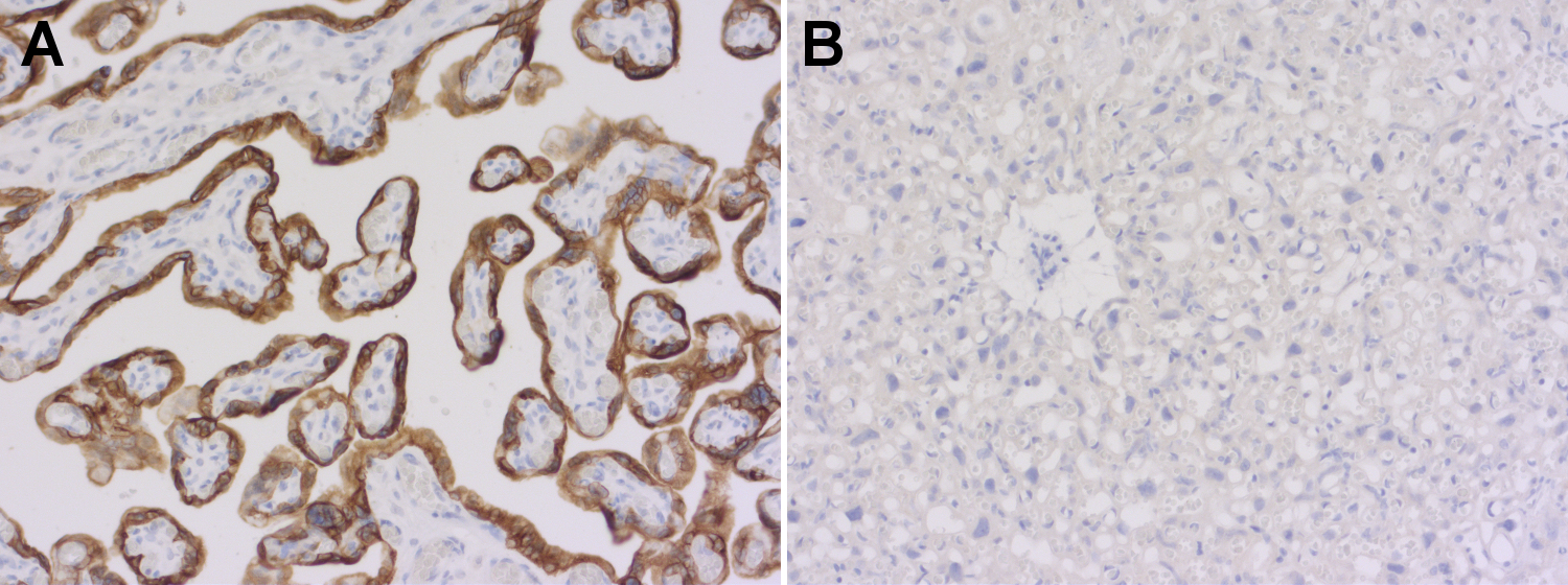  Immunohistochemical staining of CK7 using a human-specific anti-Cytokeratin 7 antibody 