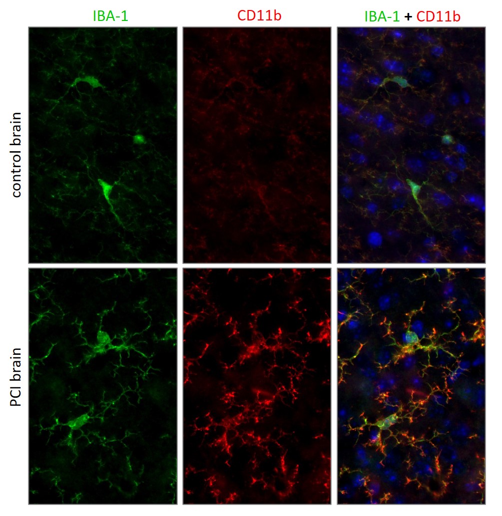 PFA fixed brain sections from a from a wild-type mouse and a sepsis mouse model