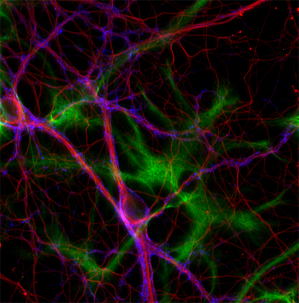 Indirect immunostaining of rat hippocampus neurons and astrocytes with anti-Δ2-tubulin.