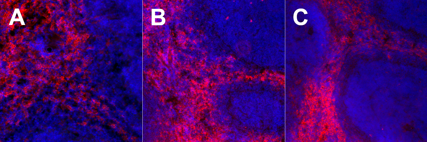 Indirect immunostaining of differently fixed mouse spleen sections with rat anti-F4/80 antibody