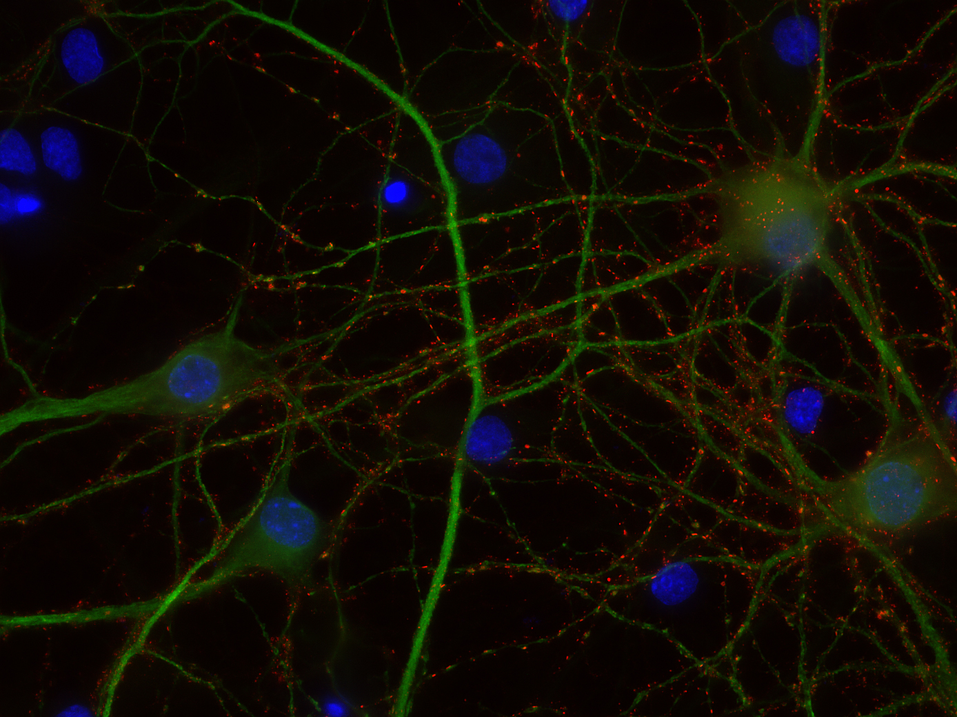 Indirect immunostaining of PFA fixed rat hippocampus neurons with mouse anti-Homer1 and rabbit anti-MAP 2 