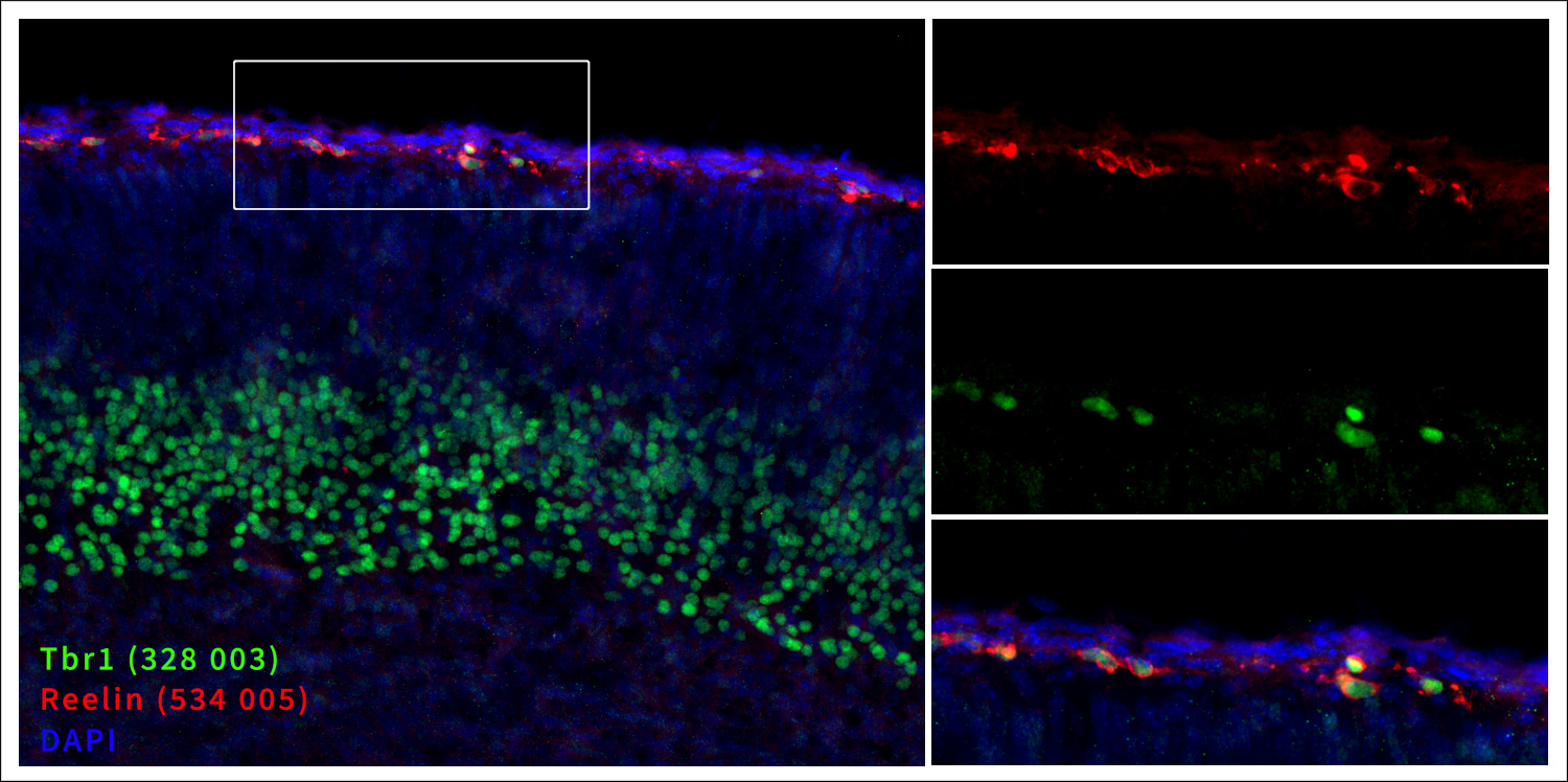 Markers of the marginal zone (MZ), Reelin and Tbr1. Indirect immunostaining of a formaldehyde-fixed mouse brain section (embryo E18, cortex) with guinea pig anti-Reelin antibody (cat. no. 534 005, dilution 1 : 500, red) and rabbit anti-Tbr1 antibody (cat. no. 328 003 dilution 1 : 500, green). Nuclei were visualized with DAPI staining (blue). 