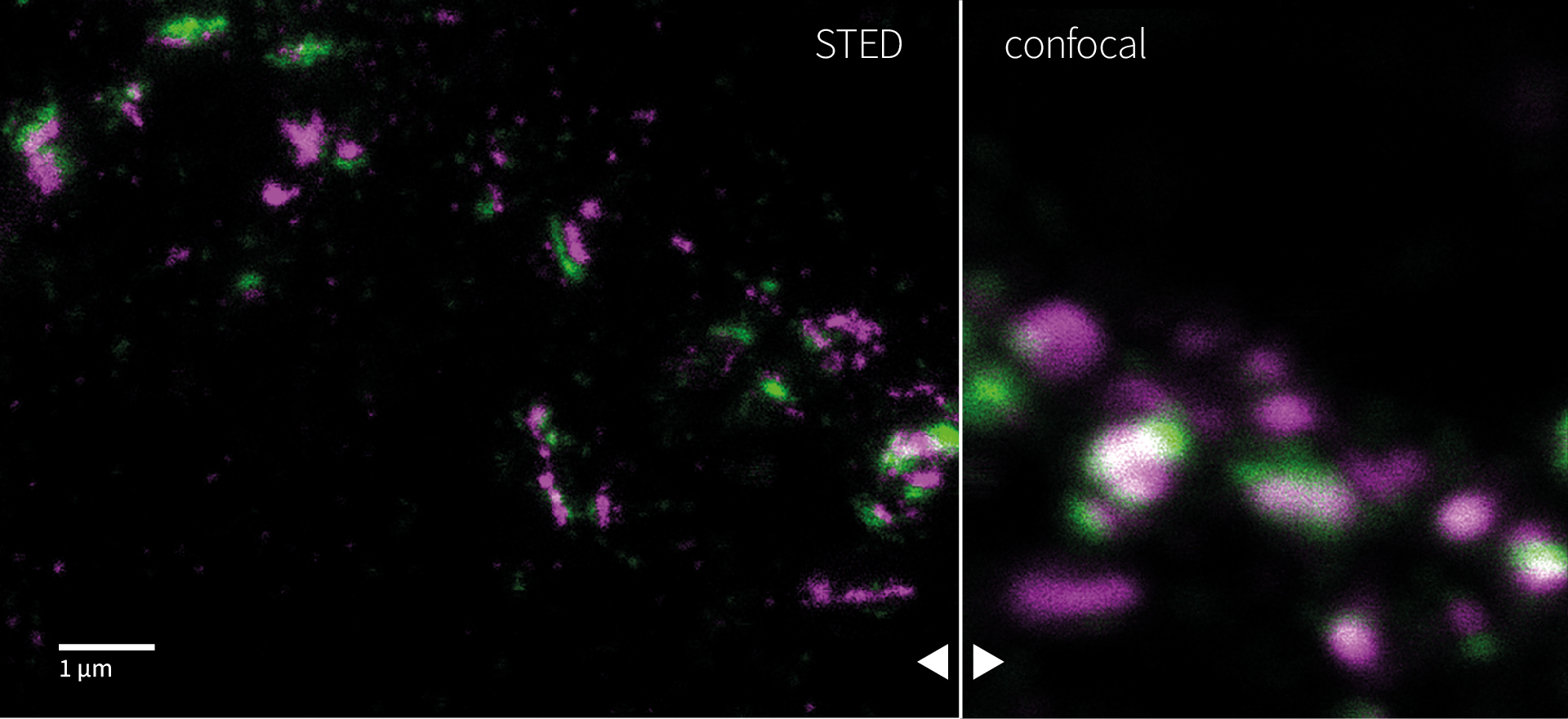Presynaptic Bassoon labelled with STAR RED and postsynaptic Homer1 labelled with STAR ORANGE