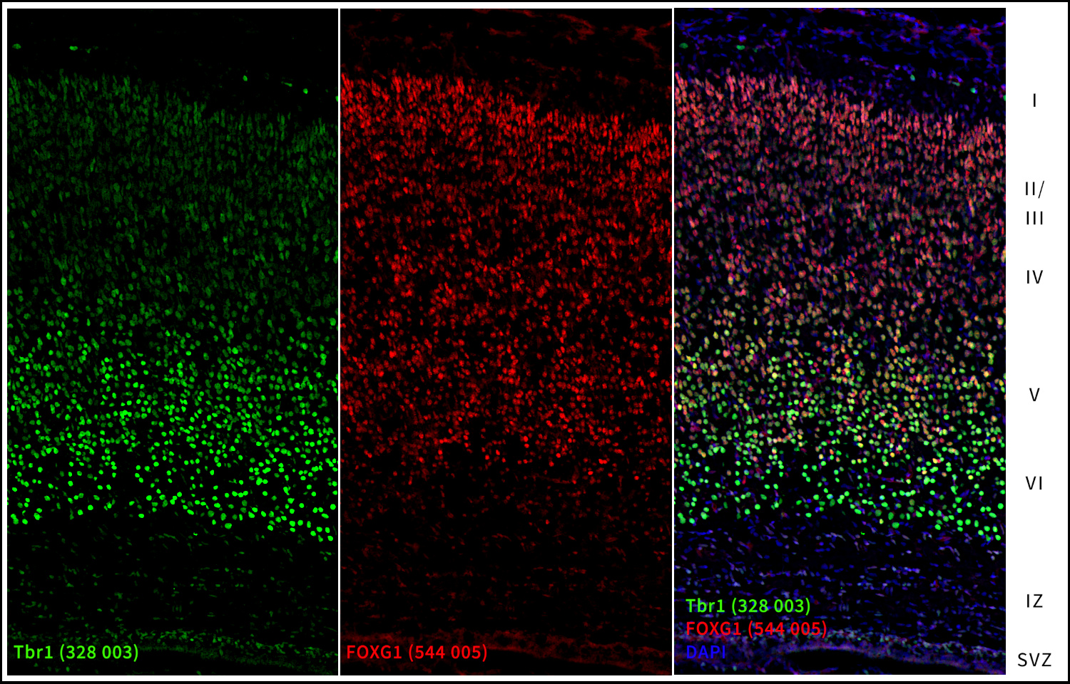 Markers of the cortical plate (CP), Tbr1 and FoxG1. Indirect immunostaining of a formaldehyde-fixed rat brain section (newborn P0, cortical plate) with rabbit anti-Tbr1 antibody (cat. no. 328 003, dilution 1 : 500, green) and guinea pig anti-FOXG1 antibody (cat. no. 544 005, dilution 1 : 1000, red). Nuclei were visualized with DAPI staining (blue).