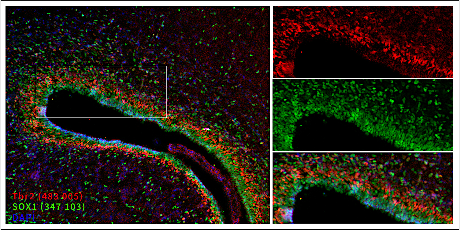 Markers of the ventricular zone (VZ, SOX1, green) and subventricular zone (SVZ, Tbr2, red). Indirect immunostaining of a formaldehyde-fixed rat brain section (embryo E18, ventricle) with rabbit anti-SOX1 antibody (cat. no. 347 103, dilution 1 : 500, green) and guinea pig anti-Tbr2 antibody (cat. no. 483 005, dilution 1 : 500, red). Nuclei were visualized with DAPI staining (blue).