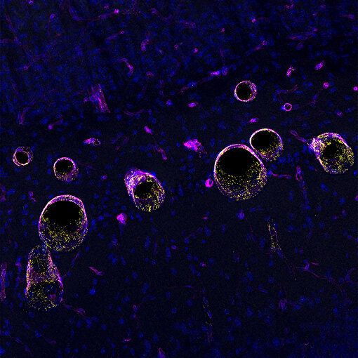 Indirect immunostaining of a formaldehyde fixed mouse brain (cortex) section with guinea pig anti-von Willebrand factor antibody (cat. no. 527 005, yellow) and rat anti-Collagen type IV antibody (cat. no. 462 017, magenta)