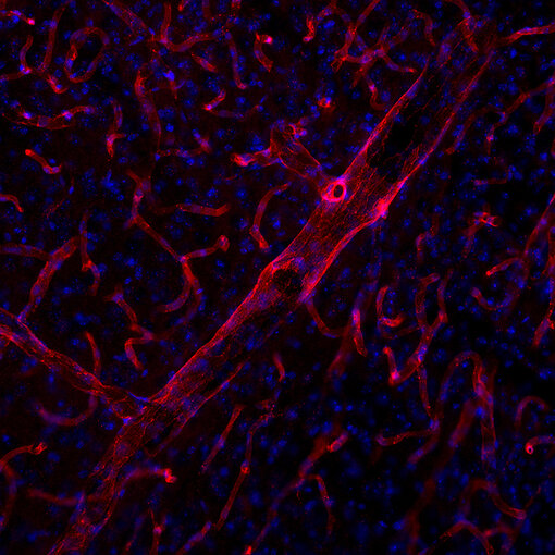 Indirect immunostaining of a formaldehyde fixed mouse brain section with rabbit anti-mouse CD31 antibody
