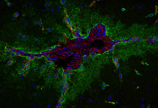  Indirect immunostaining of a fresh frozen methanol postfixed mouse brain section with guinea pig anti-Tight junction protein ZO-1 antibody (cat. no. 474 005, red) and chicken anti-Aquaporin4 antibody (cat. no. 429 009, green