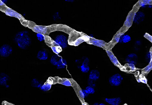 Indirect immunostaining of a formaldehyde fixed rat brain section with guinea pig anti-Collagen IV antibody (cat. no. 462 004, white). Nuclei have been visualized by DAPI staining (blue). 