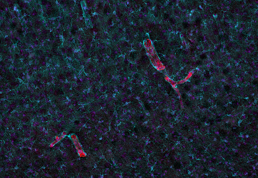  Indirect immunostaining of a glyoxal immersion fixed mouse brain section with guinea pig anti-alpha-smooth muscle actin antibody (cat. no. 449 004, red) and rabbit anti-S100B antibody (cat. no. 287 108, green).