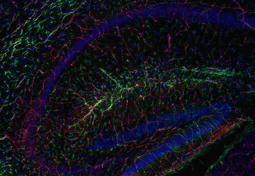 Indirect immunostaining of a glyoxal immersion fixed mouse brain (hippocampus) section with rabbit anti-ATP13A5 antibody (cat. no. 523 003, red) and guinea pig anti-GFAP antibody (cat. no. 173 308, green).