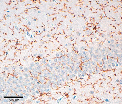 Indirect immunostaining of PFA fixed paraffin embedded mouse brain sections with rabbit anti-TMEM119