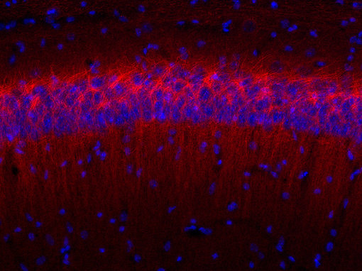 Indirect immunostaining of PFA fixed mouse hippocampus section with Guinea pig anti-Ankyrin G 