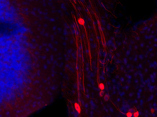 Indirect immunostaining of PFA fixed mouse pons with Guinea pig anti-Peripherin 1 