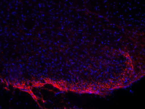 Indirect immunostaining of PFA fixed rat spinal cord section with guinea pig anti-Substance P antibody