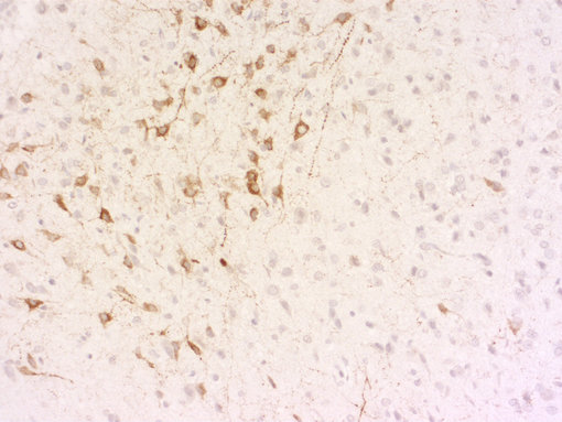 Indirect immunostaining of PFA fixed paraffin embedded rat hypothalamus section with guinea pig anti-Somatostatin-28 antibody