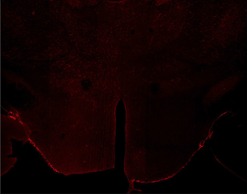 Indirect immunostaining of PFA fixed KO mouse brain sections