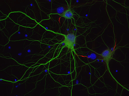 Indirect immunostaining of PFA fixed rat hippocampus neurons with anti-Ankyrin G 