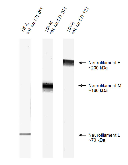Detection of Neurofilament L, M and H in Western Blot