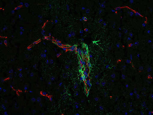 Occludin plays a role in the formation and regulation of the tight junction paracellular permeability barrier.