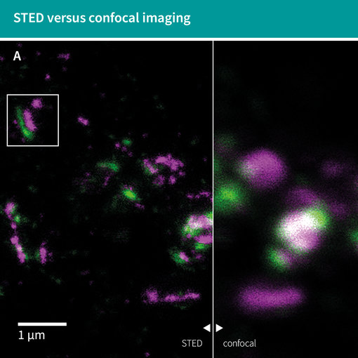 Pre-synaptic Bassoon labeled with abberior STAR RED and post-synaptic Homer1 labeled with abberior STAR ORANGE show well-separated synaptic structures using STED microscopy. STED shows a much better resolution. You can detect the pre- and post synapse 
