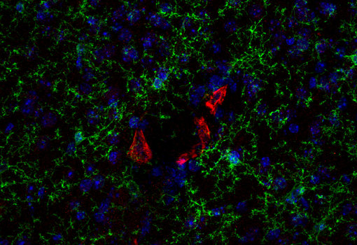 Indirect immunostaining of a formaldehyde fixed mouse cortex section with mouse anti-P2Y12 antibody