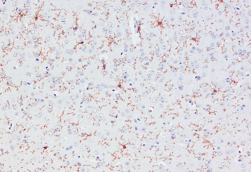 Indirect immunostaining of PFA fixed, paraffin embedded (FFPE) mouse cortex section with mouse anti-P2Y12 antibody