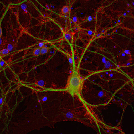 Indirect immunostaining of PFA fixed rat hippocampus neurons with anti-EAAT2 