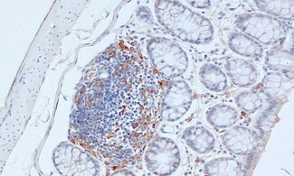 Dendritic cells act as messengers between the innate and the adaptive immune systems.