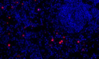 Granulocytes are innate immune cells and the most common form of leukocytes.