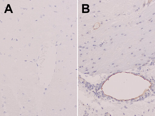 Indirect immunostaining of formalin fixed paraffin embedded (FFPE) mouse brain sections of a non-infected mouse (A) and a SARS-CoV2 infected mouse (B) with rabbit anti-ICAM1 antibody (cat. no. HS-532 003, dilution 1:1000, DAB, brown). Nuclei have been visualized by hematoxylin staining (blue).