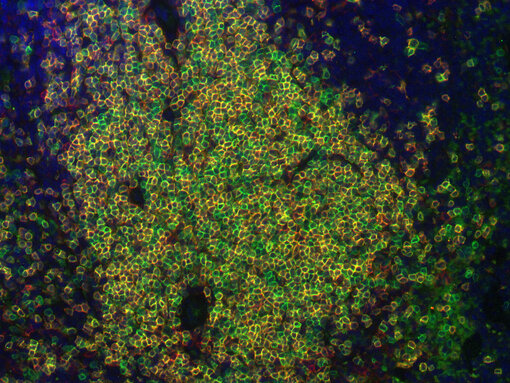  Colocalized markers in mouse spleen. Indirect immunostaining of a formalin fixed paraffin embedded (FFPE) mouse spleen section using rabbit anti-mouse CD3e (cat. no. HS-413 108, dilution 1:100, green) and rat anti-mouse CD4 (cat.no. HS-360 117, dilution 1:100, red).