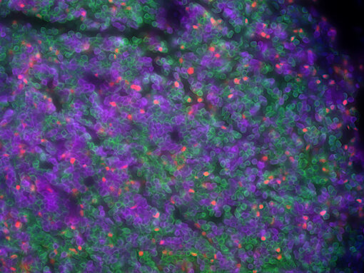 Indirect immunostaining of a formalin fixed paraffin embedded (FFPE) mouse thymus section using TSA with rat anti-FoxP3 (cat no. HS-491 017, dilution 1:1000, red), rabbit anti-CD8a (cat. no. HS-361 008, dilution 1:250, purple) and guinea pig anti-CD4 (cat. no. HS-360 308, 1:200, green). Nuclei have been visualized by DAPI staining (blue).