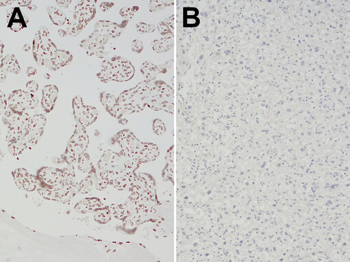Validation of species-specific antibodies using tissues from positive and negative species. Indirect immunostaining of formalin fixed paraffin embedded (FFPE) sections of human placenta (A) and mouse placenta (B) with rabbit anti-human Lamin B1 antibody (cat. no. HS-404 018, dilution 1:1000, DAB, brown). Nuclei have been visualized by hematoxylin staining (blue). 