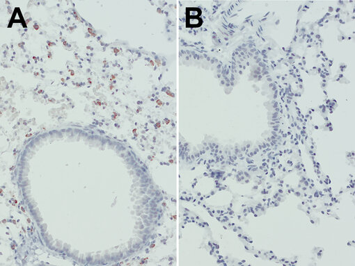Validation of primary antibodies using knockdown models. Indirect immunostaining of formalin fixed paraffin embedded (FFPE) mouse lung sections of wild type (A) or LAMP3 knock-out (B) mice with rat anti-LAMP3 antibody (cat. no. HS-391 017, dilution 1:000, DAB, brown). Nuclei have been visualized by hematoxylin staining (blue).