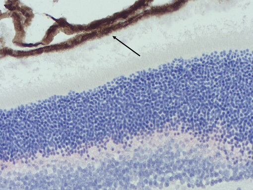 Melanin (arrow, brown) in formalin fixed paraffin embedded (FFPE) mouse retina. Nuclei have been visualized by hematoxylin staining (blue).