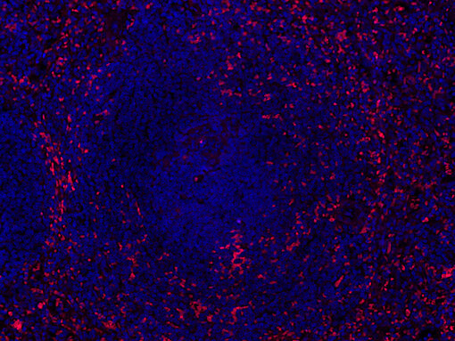Figure 4: Autofluorescence in formalin fixed paraffin embedded (FFPE) human spleen. Autofluorescence of red blood cells is shown in red. Nuclei have been visualized by DAPI staining (blue).