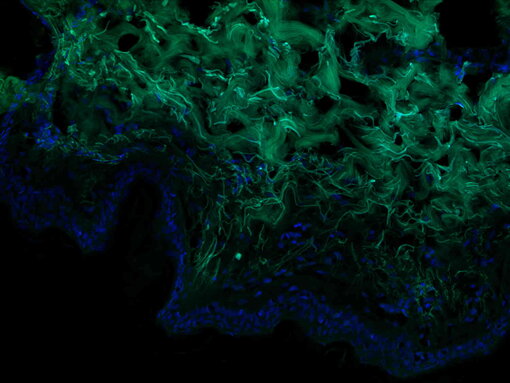Collagen-associated autofluorescence in PFA fixed human skin in FITC channel. Nuclei have been visualized by DAPI staining (blue).