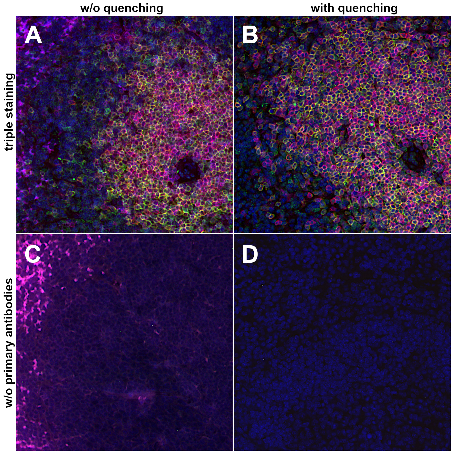 Reduction of autofluorescence using Vector TrueVIEW Autofluorescence Quenching Kit. (A, B): Indirect immunostaining of formalin fixed paraffin embedded (FFPE) mouse spleen sections using rabbit anti-CD8a (cat. no. HS-361 003, dilution 1:100, anti-rabbit Cy2, purple), rat anti-CD3e (cat. no. HS-413 117, dilution 1:100, anti-rat Cy3, red) and guinea pig anti-CD4 (cat. no. HS-360 004, dilution 1:100, anti-guinea pig Cy5, green). (C, D): Indirect immunostaining of formalin fixed paraffin embedded (FFPE) mouse spleen sections without primary antibodies but using secondary antibodies anti-rabbit Cy2 (purple), anti-rat Cy3 (red) and anti-guinea pig Cy5 (green). (B, D): The tissue sections were treated with the Vector TrueVIEW Autofluorescence Quenching Kit according to the manufacturer’s protocol. The autofluorescence detected in A & C is eliminated in B & D. Nuclei have been visualized by DAPI staining (blue).