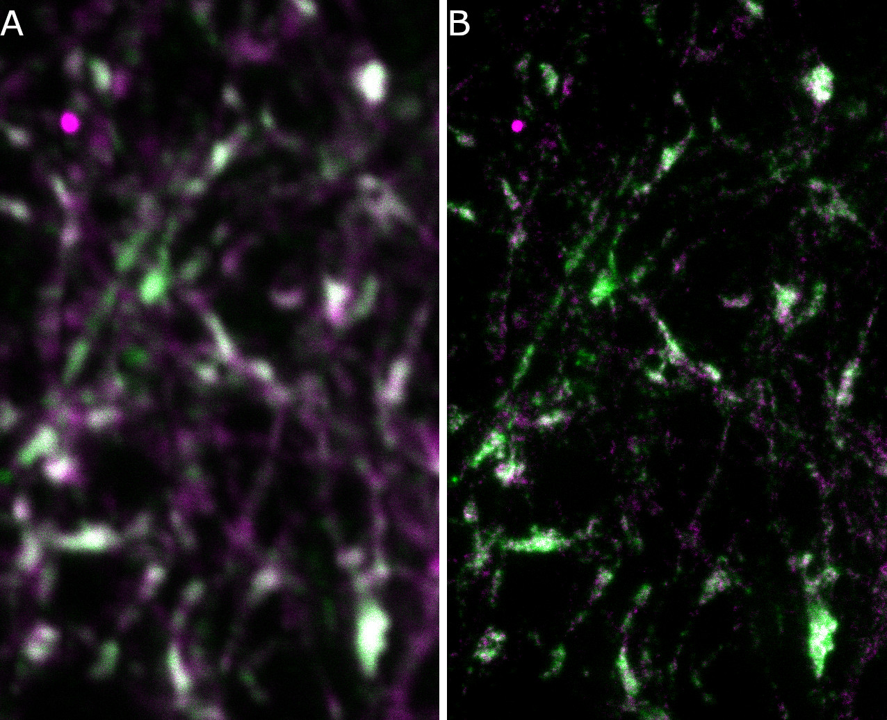 Direct immunostaining of formaldehyde fixed rat hippocampus neurons with abberior STAR ORANGE conjugated mouse anti-Synaptophysin1 antibody (cat.&nbsp;no. 101&nbsp;011AbOR, dilution 1&nbsp;:&nbsp;300, green) and abberior STAR RED conjugated mouse anti-Synaptobrevin2 antibody (cat.&nbsp;no. 104&nbsp;211AbRED, dilution 1&nbsp;:&nbsp;300, magenta) illustrates the superior resolution of STED microscopy (B) in comparison to standard confocal imaging (A).<br><br>Courtesy: Dr. Kristina Kramer, abberior GmbH, Goettingen​