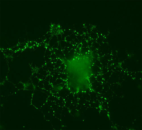 Direct immunolabeling of cultured rat hippocampus neurons.<br> antibody dilution 1&nbsp;:&nbsp;100