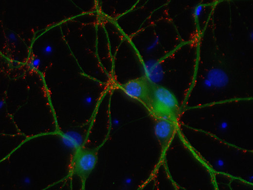 Direct immunostaining of PFA fixed rat hippocampus neurons with anti-Synaptophysin (dilution 1&nbsp;:&nbsp;500; red) and rabbit anti-MAP&nbsp;2 (cat.&nbsp;no. 188&nbsp;002, dilution 1&nbsp;:&nbsp;1000; green). Nuclei have been visualized by DAPI staining (blue).