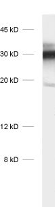 <br> antibody dilution: 1 : 1000<br> sample: protein G fraction of human serum