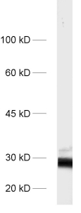 antibody dilution: 1 : 1000<br> sample: protein G fraction of human serum