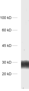 dilution: 1 : 1000<br> sample: protein G fraction from human serum